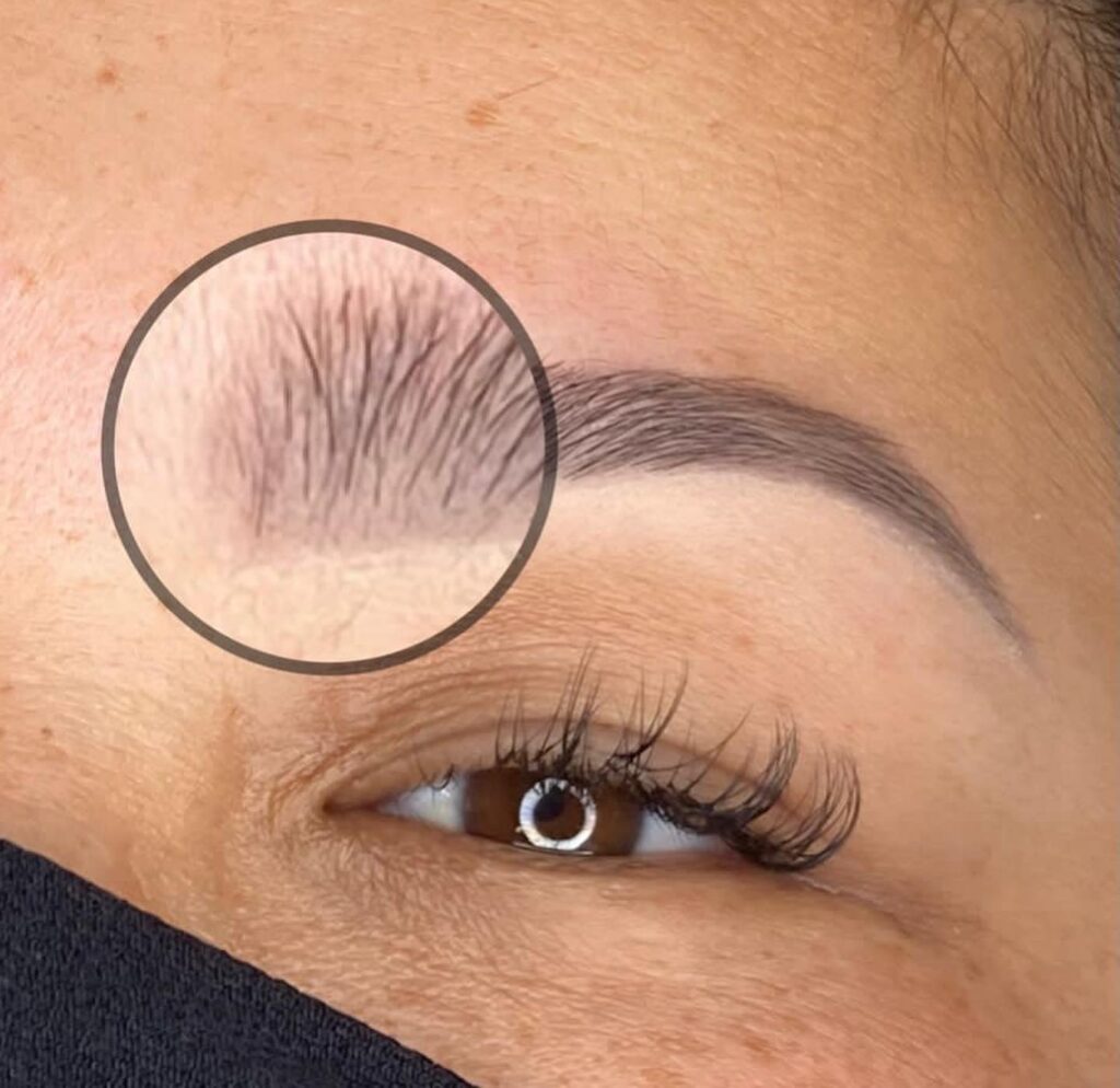 Sobrancelhas e cílios – MS Tricologia e Estética, Suzano - SP – foto 4