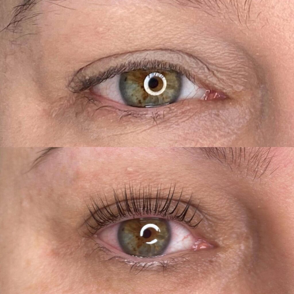 Sobrancelhas e cílios – MS Tricologia e Estética, Suzano - SP – foto 4