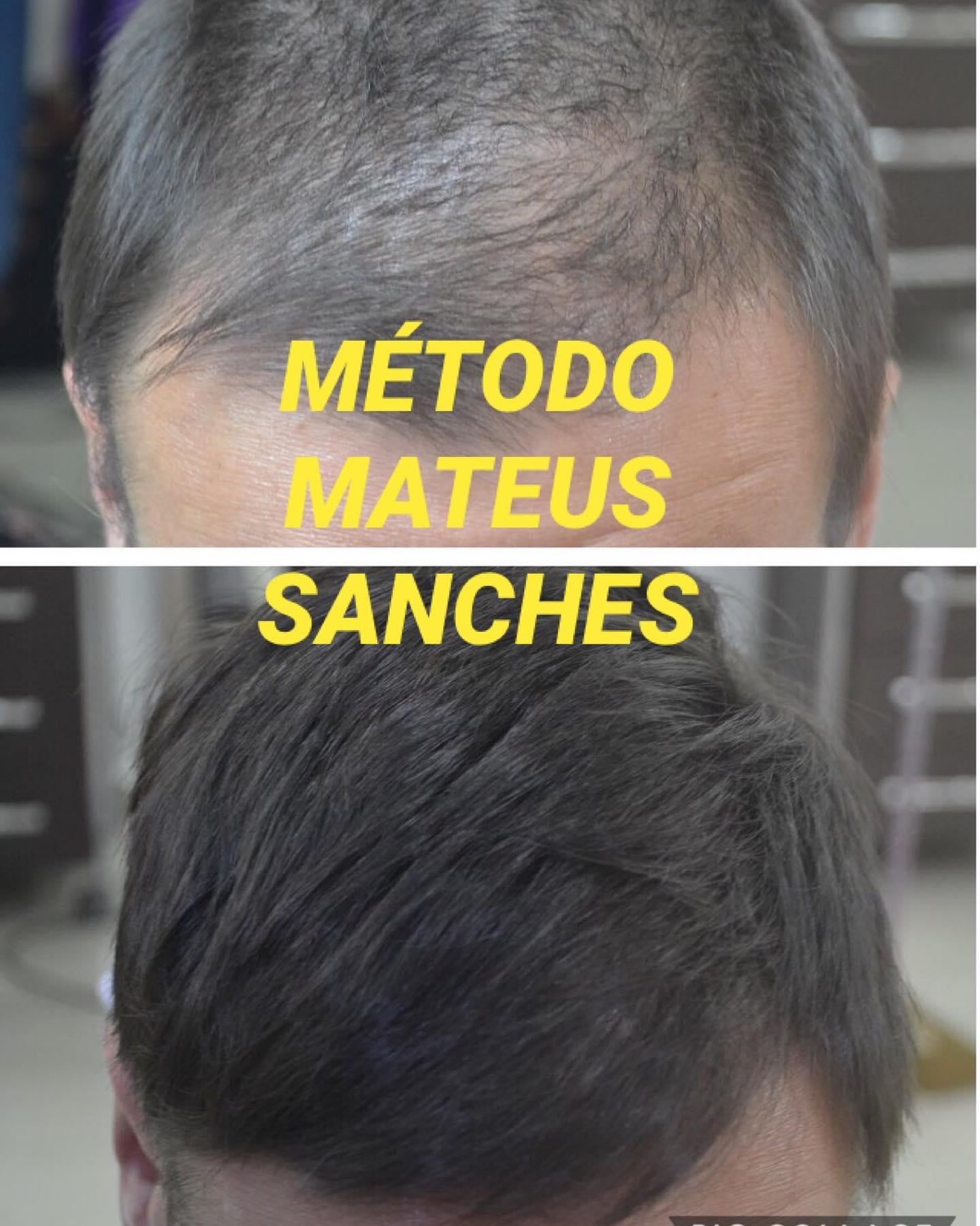 Tratamento para Queda e Crescimento Capilar em Suzano - MS Tricologia Tratamento para Queda e Crescimento Capilar em Suzano - MS Tricologia