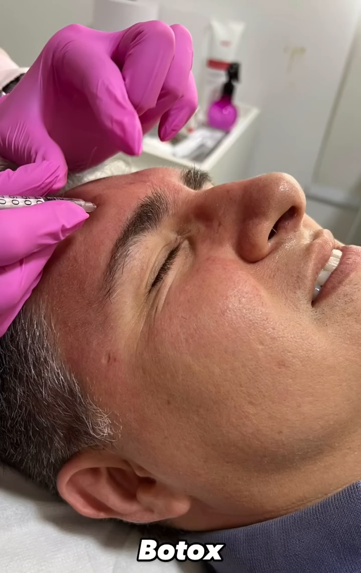 Botox e Ultraformer em Suzano – SP | MS Tricologia e Estética Botox e Ultraformer em Suzano – SP | MS Tricologia e Estética