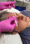 Botox e Ultraformer em Suzano – SP | MS Tricologia e Estética